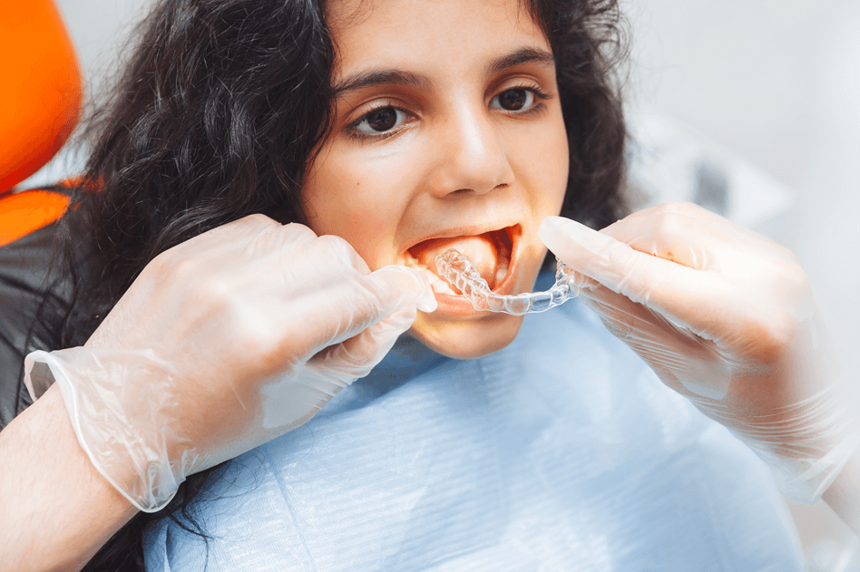 Invisalign Aligners Benefits Over Traditional Braces in Gurgaon – Myths About Aligners Explained