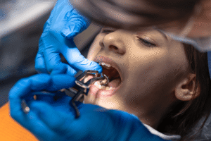 Child Dental Treatment Cost in Gurgaon Fillings Crowns and Preventive Care