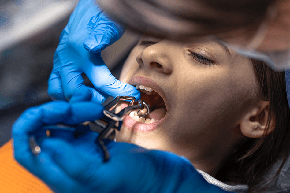child-dental-treatment-cost-in-gurgaon-fillings-crowns-and-preventive-care