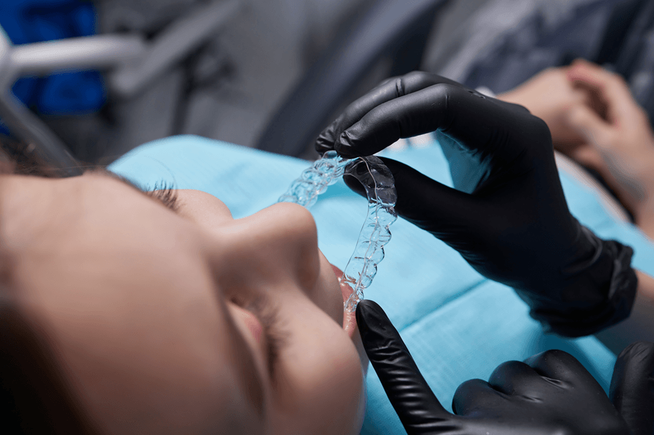 can-invisalign-fix-overbite-underbite-and-gaps-delhi-orthodontist-guide