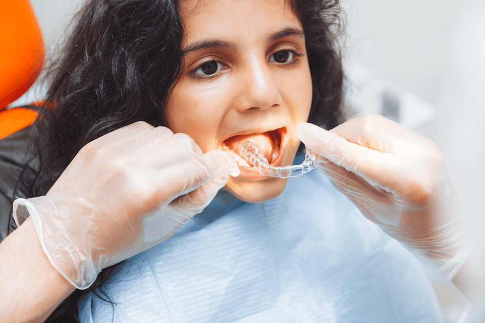 how-long-does-invisalign-take-in-gurgaon-timeline-explained-case-by-case