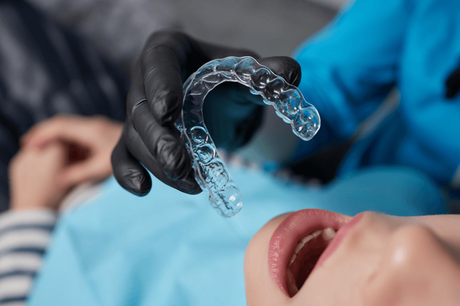 invisalign-results-in-gurgaon-before-after-timeline-breakdown